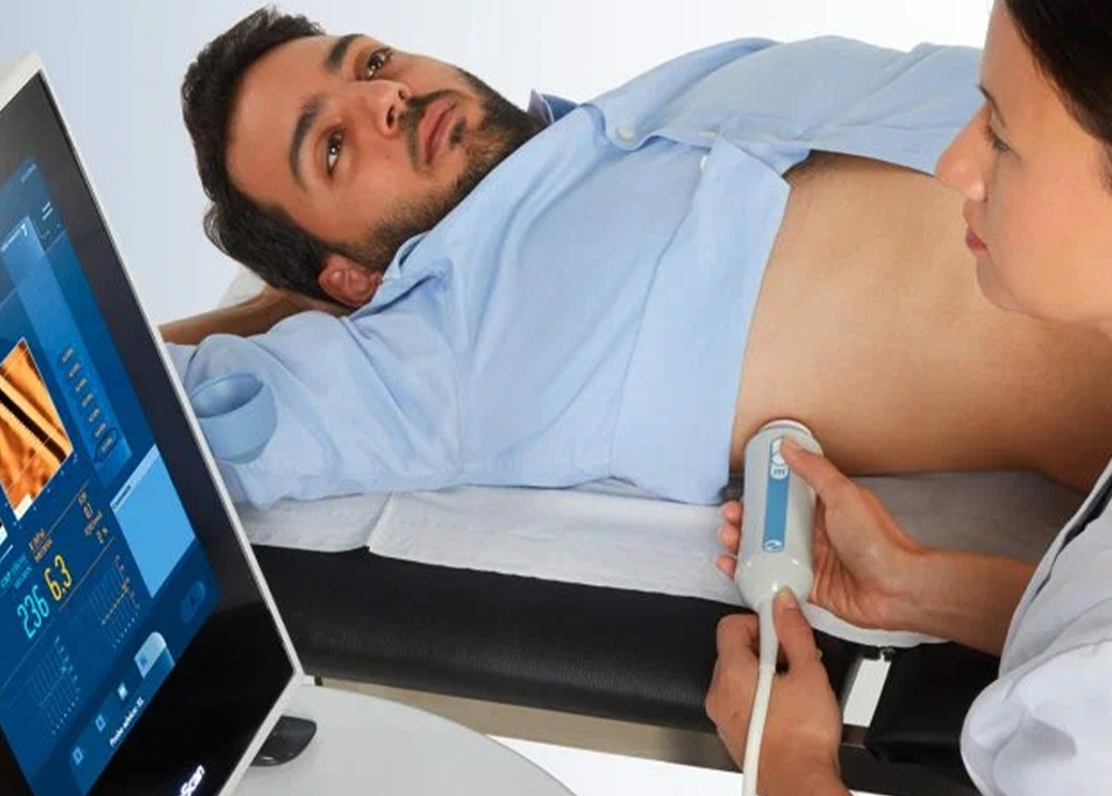 FibroScan